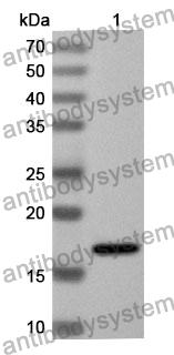 Anti-Human SERPINB4 Polyclonal Antibody