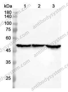 Anti-GSS Polyclonal Antibody