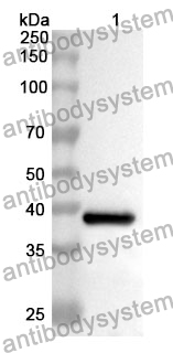 Anti-KRT6C Polyclonal Antibody