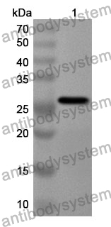 Anti-CSNK1A1 Polyclonal Antibody