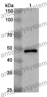 Anti-CSNK1D Polyclonal Antibody