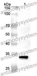 Anti-PITPNB Polyclonal Antibody