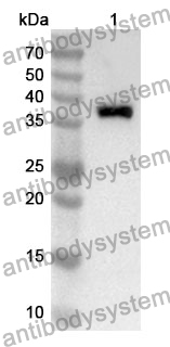 Anti-NR2C2 Polyclonal Antibody