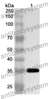 Anti-FASN Polyclonal Antibody