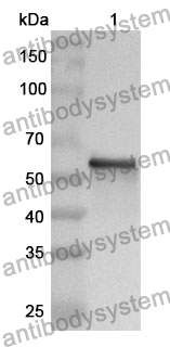 Anti-Human CCT3 Polyclonal Antibody