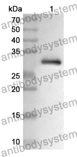 Anti-ARRB1 Polyclonal Antibody