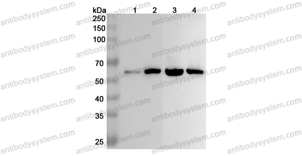 Anti-ALDH7A1 Polyclonal Antibody