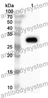 Anti-DGKG Polyclonal Antibody