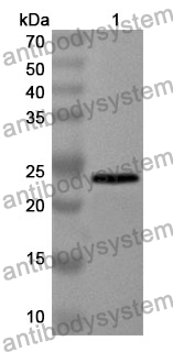 Anti-CEBPD Polyclonal Antibody