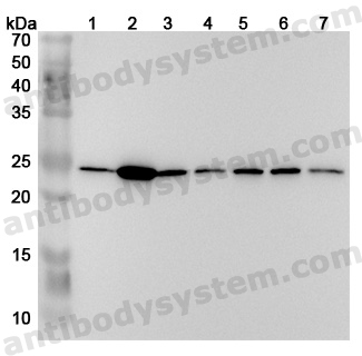 Anti-Human PSMB2 Polyclonal Antibody