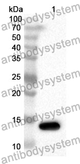 Anti-COMP Polyclonal Antibody