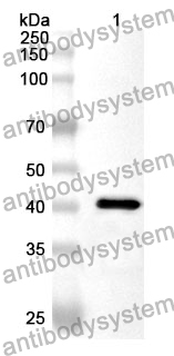 Anti-Human VPS41 Polyclonal Antibody