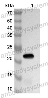 Anti-Human TMED10 Polyclonal Antibody