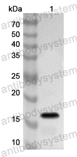 Anti-Human PGF/PlGF/PLGF Polyclonal Antibody