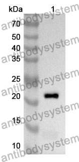 Anti-RGS4 Polyclonal Antibody