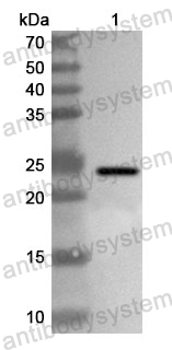 Anti-Human TSC2 Polyclonal Antibody