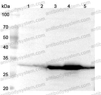 Anti-Human SULT1E1 Polyclonal Antibody