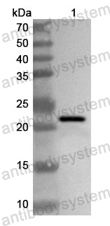 Anti-Human GMPS Polyclonal Antibody