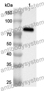 Anti-Human LIG4 Polyclonal Antibody