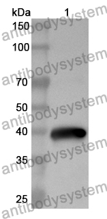 Anti-Human CD39/ENTPD1 Polyclonal Antibody