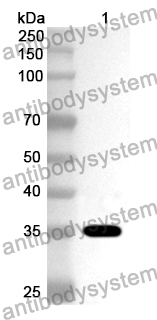 Anti-Human KHK Polyclonal Antibody