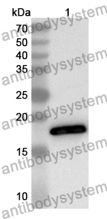 Anti-RBP2 Polyclonal Antibody