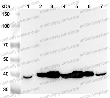 Anti-Human GNAQ Polyclonal Antibody