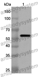 Anti-Human GDI2 Polyclonal Antibody