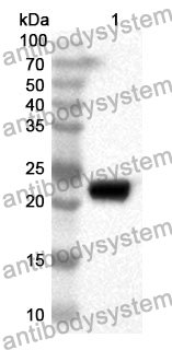 Anti-EMD Polyclonal Antibody