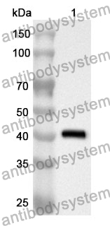 Anti-CPT1A Polyclonal Antibody