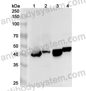 Anti-Human GATM Polyclonal Antibody