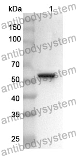 Anti-ANXA11 Polyclonal Antibody