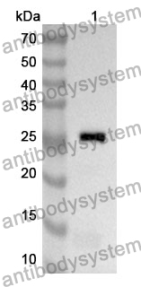 Anti-RAB7A Polyclonal Antibody