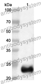 Anti-Human RAB9A Polyclonal Antibody