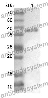 Anti-RAB28 Polyclonal Antibody