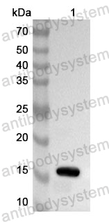 Anti-Human FABP6 Polyclonal Antibody