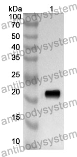 Anti-DUSP3 Polyclonal Antibody