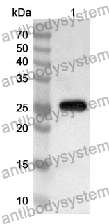 Anti-TPMT Polyclonal Antibody