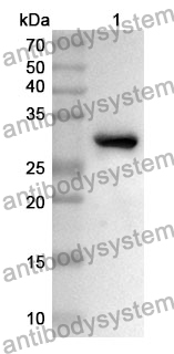 Anti-RENBP Polyclonal Antibody