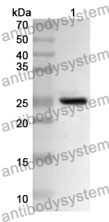 Anti-HCFC1 Polyclonal Antibody