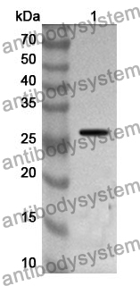 Anti-IRAK1 Polyclonal Antibody