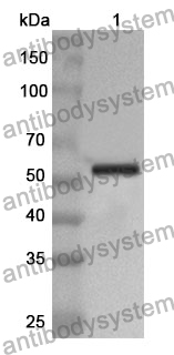 Anti-SUOX Polyclonal Antibody