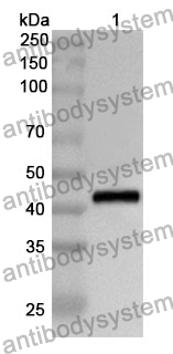 Anti-STAT5B Polyclonal Antibody