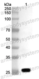 Anti-CLCN7 Polyclonal Antibody