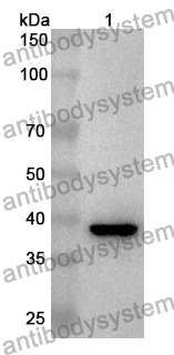 Anti-Human RPS6KA3 Polyclonal Antibody