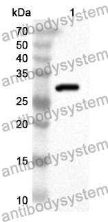 Anti-BMX Polyclonal Antibody