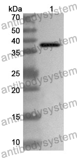 Anti-LUM/Lumican Polyclonal Antibody