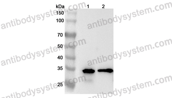 Anti-CNN1 Polyclonal Antibody