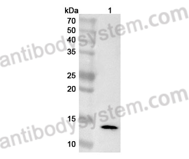 Anti-Human MNAT1 Polyclonal Antibody