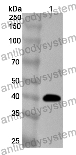 Anti-Human FUT6 Polyclonal Antibody